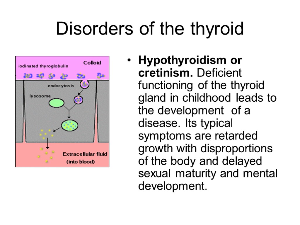 Disorders of the thyroid Hypothyroidism or cretinism. Deficient functioning of the thyroid gland in